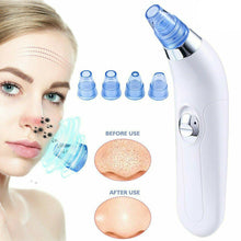 Load image into Gallery viewer, Blackhead Remover Vaccum Suction Facial Cleaner - goget-glow.com