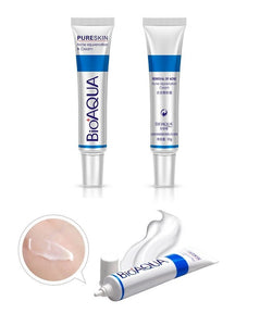 Acne Treatment Blackhead Remove Anti Acne Cream - goget-glow.com