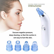 Load image into Gallery viewer, Blackhead Remover Vaccum Suction Facial Cleaner - goget-glow.com
