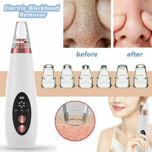 Blackhead Black Dot Remover Face Pore Vacuum Skin Care - goget-glow.com